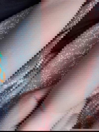 สอบถามเรื่องผื่นแดง