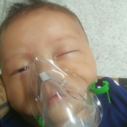 วิธีดูแลลูกน้อยเป็นโรคหอบหืด