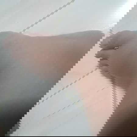 HELP Manas or Swelling