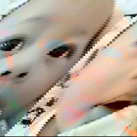 bibir putih cara menyembuhkannya