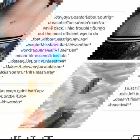 Stretchmarks remedy..