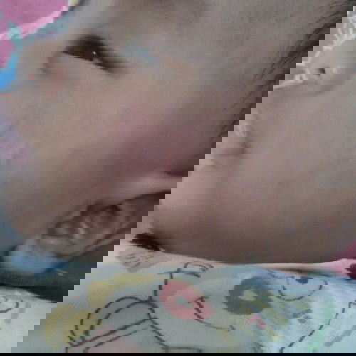 wajah bayi kasar,  tambah merah setelah d kasih baby cream