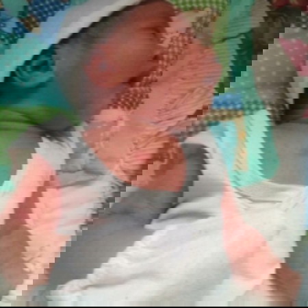 Baby Rashes