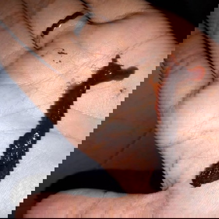 flek coklat seperti ager