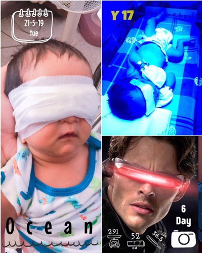ค่าเหลืองไม่ผ่าน