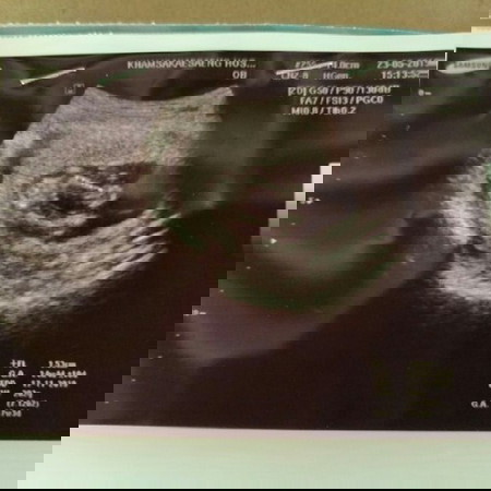 16 W 5 D อยากทราบเพศน้องคะ
