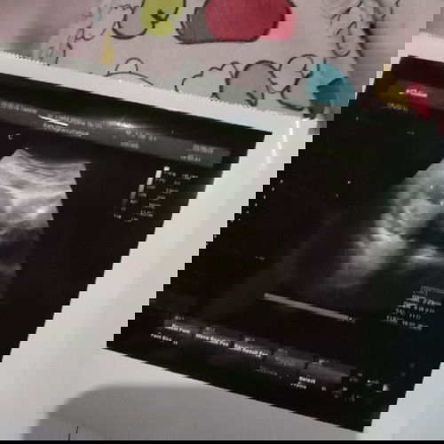 9week baru kelihatan kantung khamilan