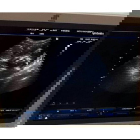 น้องเเข็งแรงดีใช่มั้ย