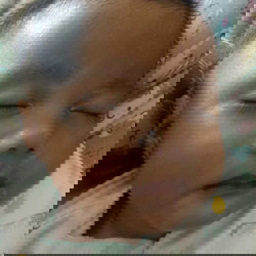 kulit bayi putih sebagian