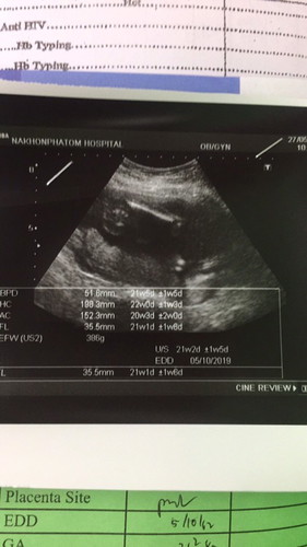 แบบนี้รู้หรือยังค่ะว่าเพศอะไร