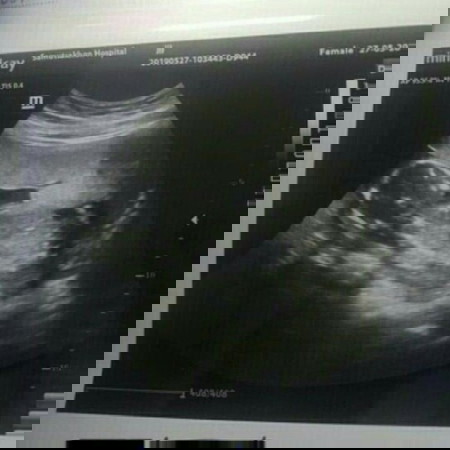 เพศหญิงรือชายค่ะ น้องยุขวางอันตรายไหมค่ะ