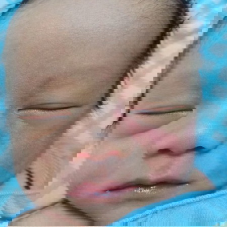 สอบถามปานแดง