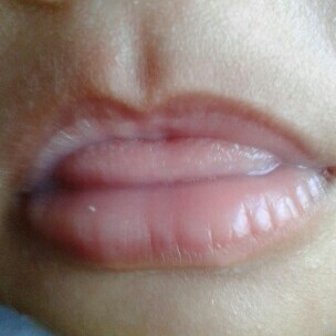 bibir bayi