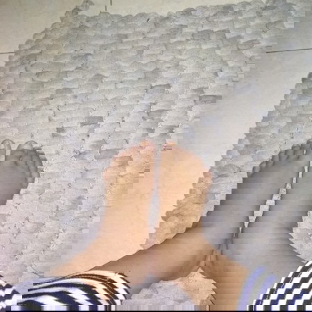 Kaki Bengkak Usia Kehamilan 38minggu