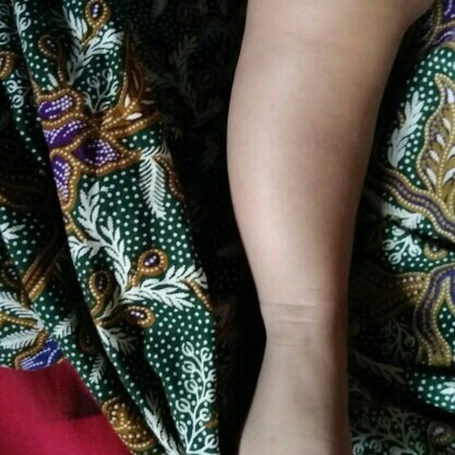 kaki bayi