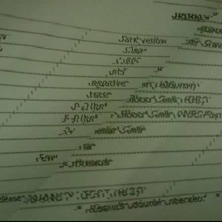 Wbc count