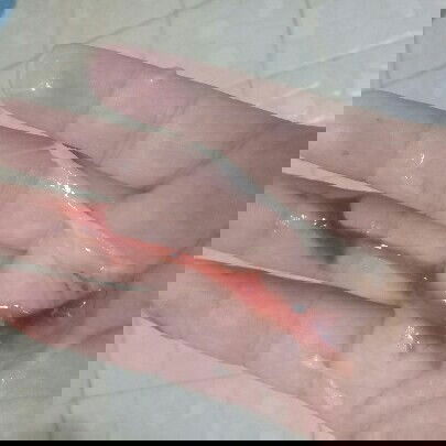 ตรวจปากมดลูกเปิด