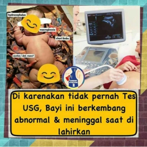 Post reply image