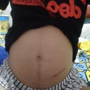 แม่ๆช่วยดูหน่อยค่ะ ท้องแบบนี้ได้หญิงหญิงรึชายค่ะ