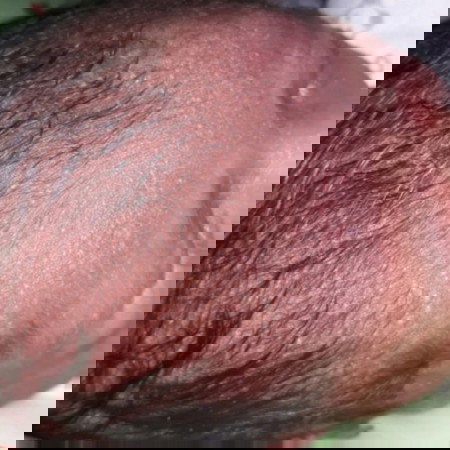 bintik2