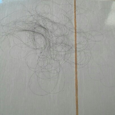 rambut rontok