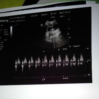 hamil 3 bulan