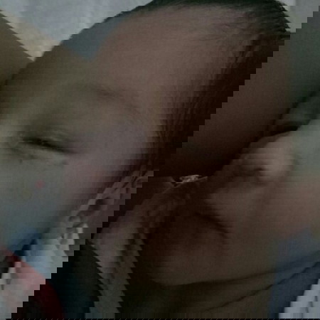 Newborn Eye Discharge
