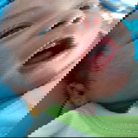 bintik merah
