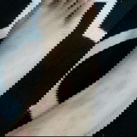 gatal2