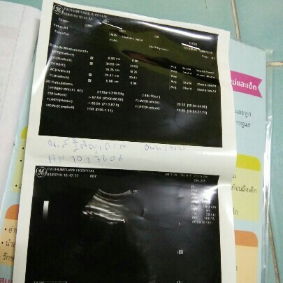 แบบนี้ผู้หญิงหรือผู้ชายค่ะ