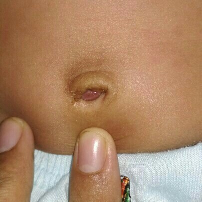 pusar masih merah