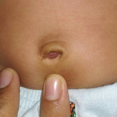pusar masih merah