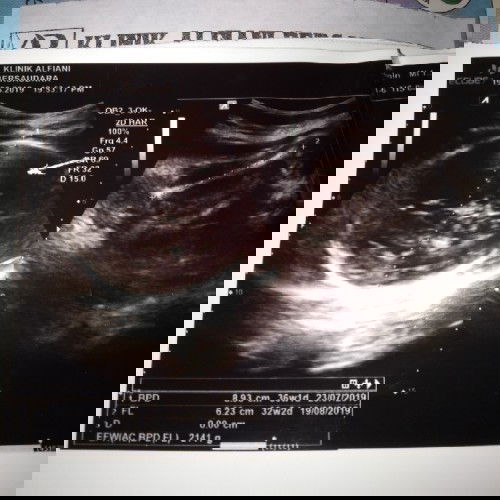 menanti kelahiran buah hati