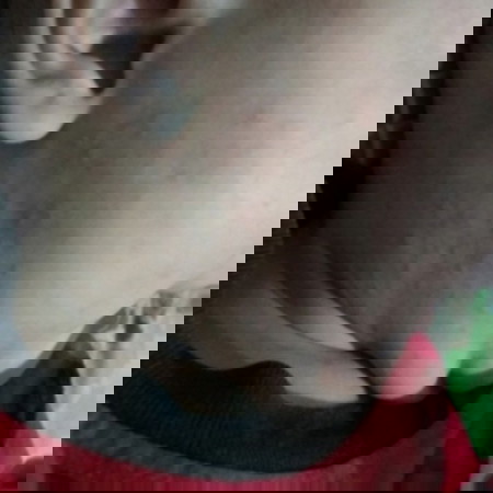 seluruh badan bintik merah setelah demam