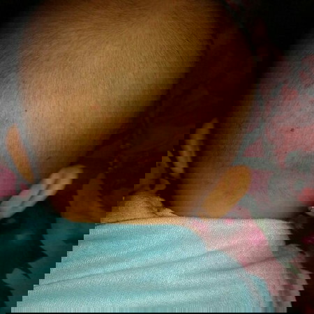 gatal