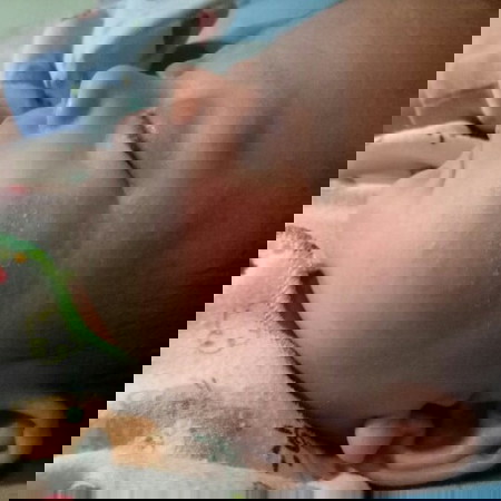 bintik kemerahan melebar dipipi