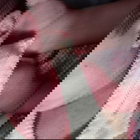 bintik bintik d seluruh badan