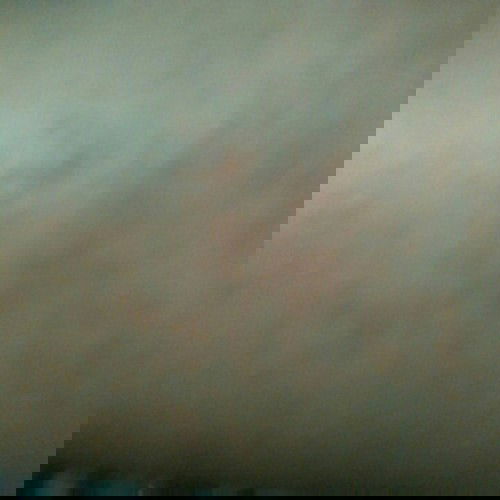 kulit sensitif kala musim kemarau dan cuaca dingin...