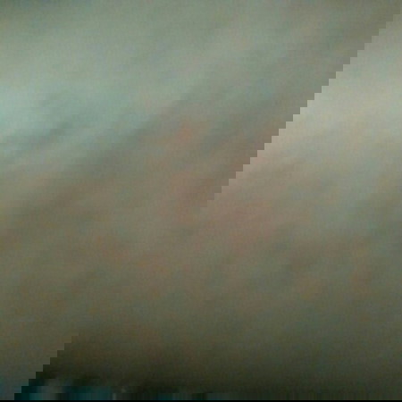 kulit sensitif kala musim kemarau dan cuaca dingin...