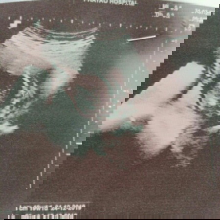 เพศอะไรคพ