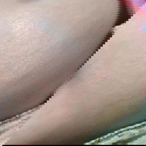 kulit kering efek cuaca