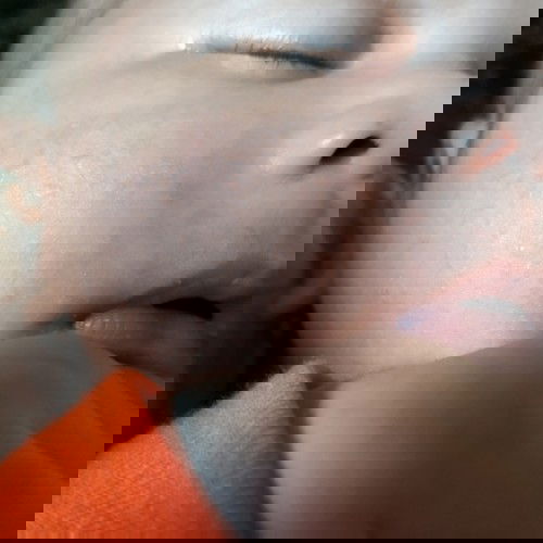 kulit wajah kasar dan bintik merah