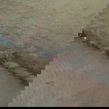 Luka Pasca Operasi SC Memerah