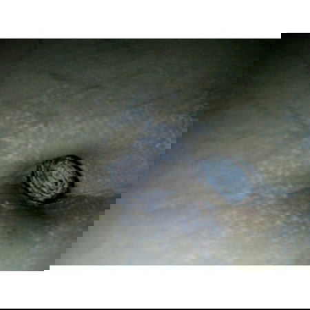 ada yang aneh di pusar