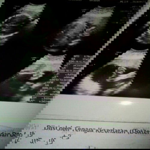 kebahagiaan calon ibu