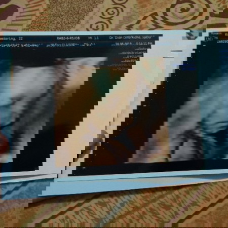 22minggu