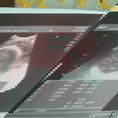 gmbr scan