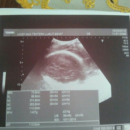 gmbr scan