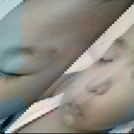 white spots