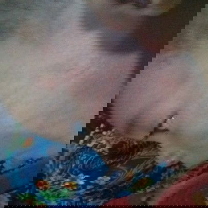 merah pada pipi bayi